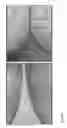 Fig. 11 - Break resistant gel capsule