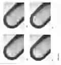 Fig. 18 - Break resistant gel capsule