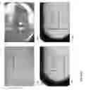 Fig. 22 - Break resistant gel capsule