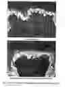 Fig. 03 - Use of vernonia extract