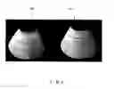 Fig. 05 - Fiber preform, fiber reinforced composite, and method of making thereof