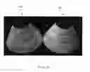 Fig. 07 - Fiber preform, fiber reinforced composite, and method of making thereof