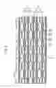 Fig. 05 - Fuel cell stack
