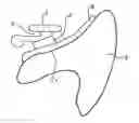 Fig. 01 - Method for producing a customized orthodontic device