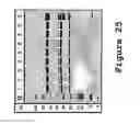 Fig. 14 - Nucleic acids encoding interleukin-12P40 variants with improved stability