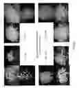 Fig. 22 - Cardiomyocyte production