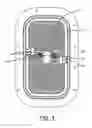 Fig. 10 - Vent apparatus