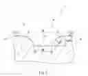 Fig. 04 - Golf club head