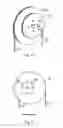 Fig. 07 - Tension systems and methods of use