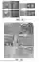 Fig. 06 - RNA interference for the treatment of heart failure