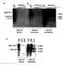 Fig. 01 - METHODS OF DETECTING LONG RANGE CHROMOSOMAL INTERACTIONS