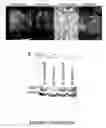Fig. 06 - NUCLEIC ACID MOLECULE AND METHOD OF TARGETING GENE EXPRESSION TO GLIOMAS