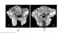Fig. 01 - BONE CEMENT MIXTURE FOR PRODUCING AN MRT-SIGNALING BONE CEMENT