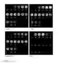 Fig. 02 - BONE CEMENT MIXTURE FOR PRODUCING AN MRT-SIGNALING BONE CEMENT
