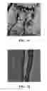 Fig. 09 - COMPOSITIONS AND ARTICLES FOR HIGH-TEMPERATURE WEAR USE