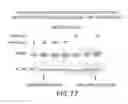 Fig. 89 - siRNA useful to supress expression of EIF-5A1