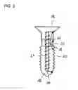 Fig. 03 - Apparatus for Stimulating a Healing Process in the Region of an Implant