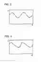 Fig. 04 - Apparatus for Stimulating a Healing Process in the Region of an Implant