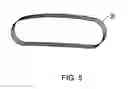 Fig. 05 - Apparatus for Stimulating a Healing Process in the Region of an Implant