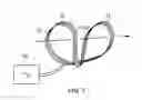 Fig. 07 - Apparatus for Stimulating a Healing Process in the Region of an Implant