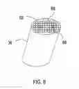 Fig. 08 - Apparatus for Stimulating a Healing Process in the Region of an Implant