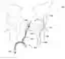 Fig. 01 - Pelvic floor repair system