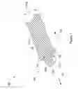 Fig. 02 - Pelvic floor repair system