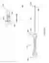 Fig. 15 - Pelvic floor repair system