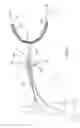 Fig. 03 - Apparatus and method for suspending a uterus