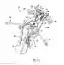 Fig. 02 - Surgical access system and related methods