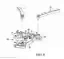 Fig. 09 - Surgical access system and related methods
