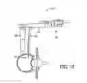 Fig. 16 - Surgical access system and related methods