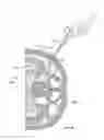Fig. 30 - Surgical access system and related methods