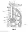 Fig. 47 - Surgical access system and related methods