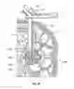 Fig. 50 - Surgical access system and related methods