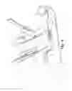 Fig. 05 - TISSUE MASSAGE RETRACTOR