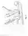 Fig. 06 - TISSUE MASSAGE RETRACTOR
