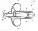 Fig. 01 - Speculum