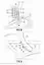Fig. 06 - Speculum