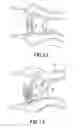 Fig. 08 - Speculum