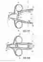 Fig. 10 - Speculum