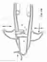 Fig. 12 - Speculum