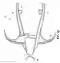 Fig. 13 - Speculum