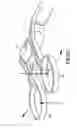 Fig. 18 - Speculum