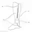 Fig. 01 - Method and apparatus for diagnosing and treating vascular disease