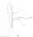 Fig. 03 - Method and apparatus for diagnosing and treating vascular disease