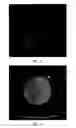Fig. 13 - Method and apparatus for standardizing ultrasonography training using image to physical space registration of tomographic volumes from tracked ultrasound
