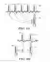 Fig. 09 - Methods and devices for identifying overdetection of cardiac signals