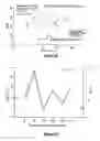 Fig. 07 - Detection of hypokinetic and hyperkinetic states