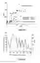 Fig. 08 - Detection of hypokinetic and hyperkinetic states